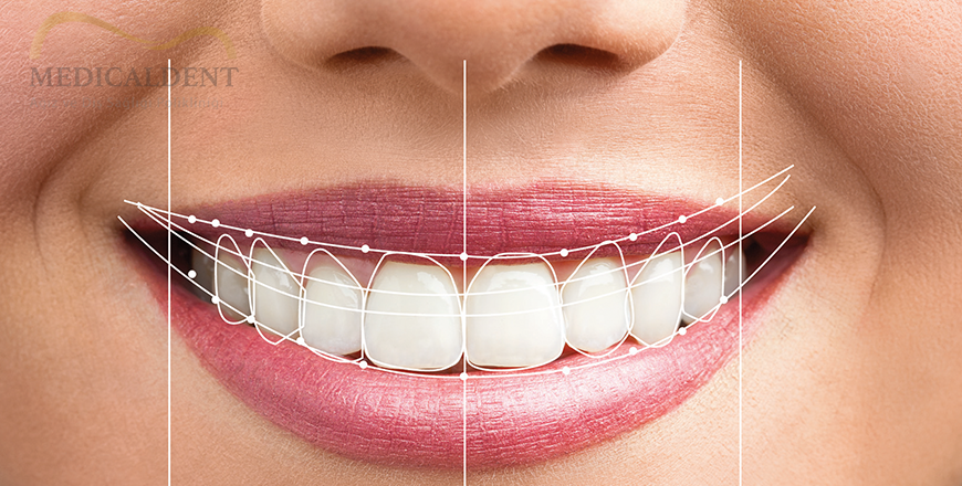 Smile Design & Esthetics